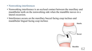 Lateral Excursion Interferences OCCLUSION IN FPD prosthodontics seminar final year | PPTX