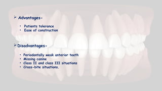  Advantages-
• Patients tolerance
• Ease of construction
Disadvantages-
• Periodontally weak anterior teeth
• Missing canine
• Class II and class III situations
• Cross-bite situations.
 