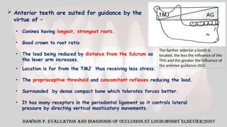  Anterior teeth are suited for guidance by the
virtue of –
• Canines having longest, strongest roots.
• Good crown to root ratio
• The load being reduced by distance from the fulcrum as
the lever arm increases.
• Location is far from the TMJ thus receiving less stress.
• The proprioceptive threshold and concomitant reflexes reducing the load.
• Surrounded by dense compact bone which tolerates forces better.
• It has many receptors in the periodontal ligament so it controls lateral
pressure by directing vertical masticatory movements.
Dawson P. Evaluation and Diagnosis of Occlusion.St.Louis:Mosby Elsevier;2007
The farther anterior a tooth is
located, the less the influence of the
TMJ and the greater the influence of
the anterior guidance (AG).
 
