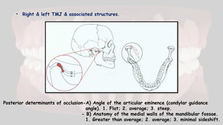 • Right & left TMJ & associated structures.
Posterior determinants of occlusion-A) Angle of the articular eminence (condylar guidance
angle). 1. Flat; 2. average; 3. steep.
- B) Anatomy of the medial walls of the mandibular fossae.
1. Greater than average; 2. average; 3. minimal sideshift.
 