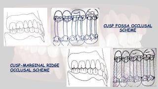 CUSP FOSSA OCCLUSAL
SCHEME
CUSP-MARGINAL RIDGE
OCCLUSAL SCHEME
 