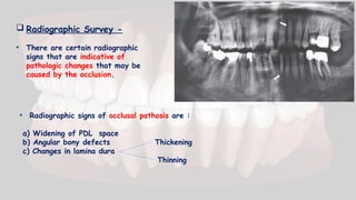  Radiographic Survey -
• There are certain radiographic
signs that are indicative of
pathologic changes that may be
caused by the occlusion.
• Radiographic signs of occlusal pathosis are :
a) Widening of PDL space
b) Angular bony defects Thickening
c) Changes in lamina dura
Thinning
 