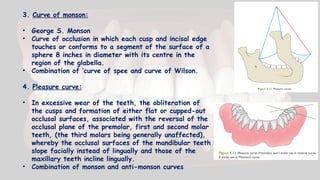 3. Curve of monson:
• George S. Monson
• Curve of occlusion in which each cusp and incisal edge
touches or conforms to a segment of the surface of a
sphere 8 inches in diameter with its centre in the
region of the glabella.
• Combination of ‘curve of spee and curve of Wilson.
4. Pleasure curve:
• In excessive wear of the teeth, the obliteration of
the cusps and formation of either flat or cupped-out
occlusal surfaces, associated with the reversal of the
occlusal plane of the premolar, first and second molar
teeth, (the third molars being generally unaffected),
whereby the occlusal surfaces of the mandibular teeth
slope facially instead of lingually and those of the
maxillary teeth incline lingually.
• Combination of monson and anti-monson curves
 