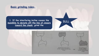 1. If the interfering incline causes the
mandible to deviate off the line of closure
toward the cheek, grind the
Basic grinding rules-
BULL
 