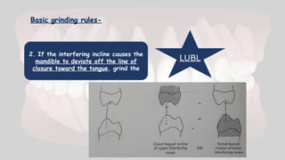 Basic grinding rules-
2. If the interfering incline causes the
mandible to deviate off the line of
closure toward the tongue, grind the
LUBL
 