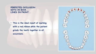 PERFECTED OCCLUSION
DOTS IN BACK...
LINES IN FRONT...
• This is the ideal result of marking
with a red ribbon while the patient
grinds the teeth together in all
excursions.
 