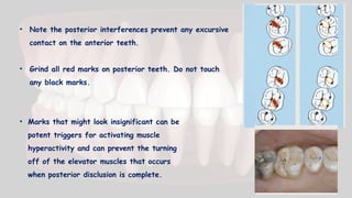• Note the posterior interferences prevent any excursive
contact on the anterior teeth.
• Grind all red marks on posterior teeth. Do not touch
any black marks.
• Marks that might look insignificant can be
potent triggers for activating muscle
hyperactivity and can prevent the turning
off of the elevator muscles that occurs
when posterior disclusion is complete.
 