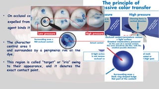 • On occlusal contact, the coloring agent is
expelled from the film and the bonding
agent binds it on to the tooth surface.
• The characteristic marking is observed as a
central area that is devoid of the colorant
and surrounded by a peripheral rim of the
dye.
• This region is called “target” or “iris” owing
to their appearance, and it denotes the
exact contact point.
 