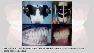 Shetty Et al . PHILOSOPHIES IN FULL MOUTH REHABILITATION – A SYSTEMATIC REVIEW.
IJDCR 2013; 3(3): 30-39.
 
