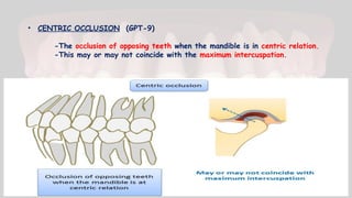 • CENTRIC OCCLUSION (GPT-9)
-The occlusion of opposing teeth when the mandible is in centric relation.
-This may or may not coincide with the maximum intercuspation.
 