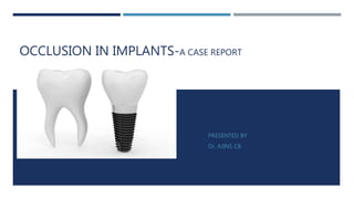 OCCLUSION IN IMPLANTS-A CASE REPORT
PRESENTED BY
Dr. AJINS CB
 