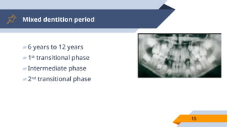 Mixed dentition period
▰6 years to 12 years
▰1st
transitional phase
▰Intermediate phase
▰2nd
transitional phase
15
 