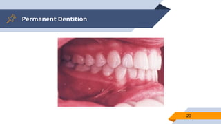 Permanent Dentition
20
 