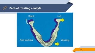 Path of rotating condyle
31
 