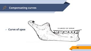 Compensating curves
42
▰ Curve of spee -
 