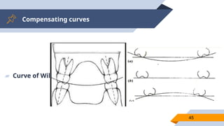 Compensating curves
45
▰ Curve of Willson -
 