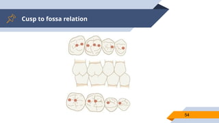 Cusp to fossa relation
54
 