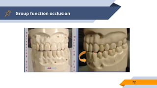 Group function occlusion
72
 