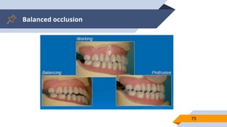 Balanced occlusion
75
 