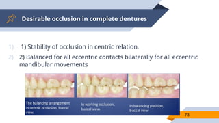 Desirable occlusion in complete dentures
78
1) 1) Stability of occlusion in centric relation.
2) 2) Balanced for all eccentric contacts bilaterally for all eccentric
mandibular movements
 