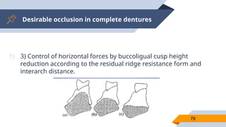 Desirable occlusion in complete dentures
79
1) 3) Control of horizontal forces by buccoligual cusp height
reduction according to the residual ridge resistance form and
interarch distance.
 