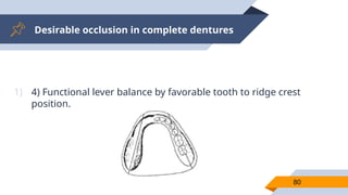 Desirable occlusion in complete dentures
80
1) 4) Functional lever balance by favorable tooth to ridge crest
position.
 