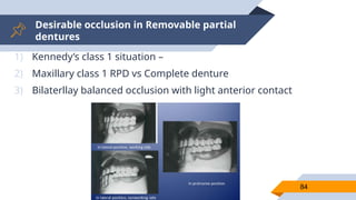 Desirable occlusion in Removable partial
dentures
84
1) Kennedy’s class 1 situation –
2) Maxillary class 1 RPD vs Complete denture
3) Bilaterllay balanced occlusion with light anterior contact
 