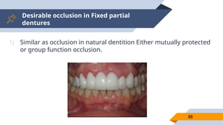 Desirable occlusion in Fixed partial
dentures
88
1) Similar as occlusion in natural dentition Either mutually protected
or group function occlusion.
 