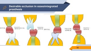 Desirable occlusion in osseointegrated
prosthesis
93
 