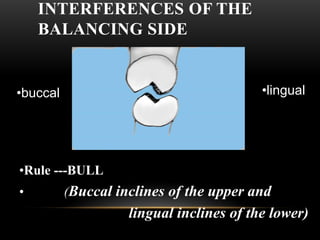 Occlusion in removable partial Denture | PDF