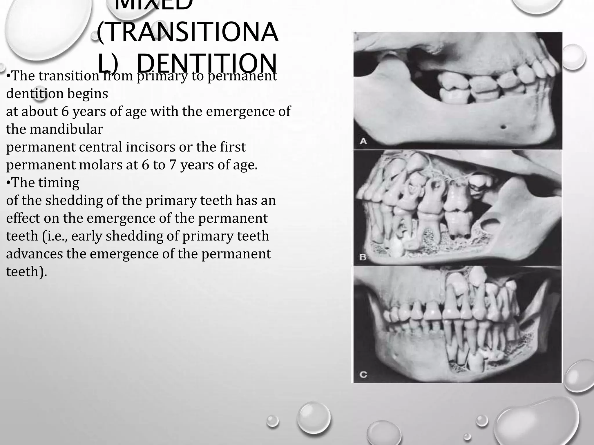 Transitional Teeth OCCLUSION | PPTX
