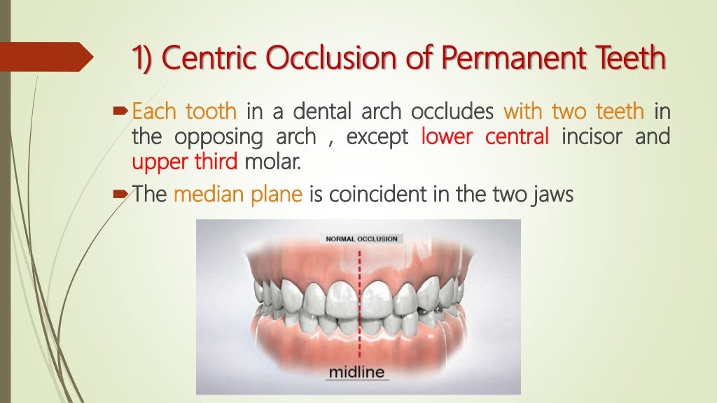 Occlusion part 2 final