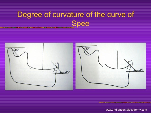 curve of spee
