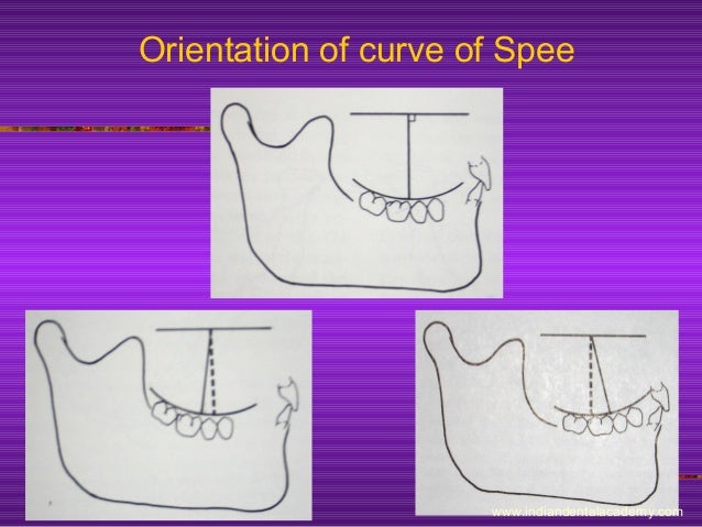curve of spee