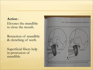 Action :
Elevates the mandible
to close the mouth.

Retraction of mandible
& clenching of teeth.

Superficial fibers help
in protrusion of
mandible.
 