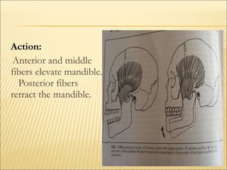 Action:
 Anterior and middle
fibers elevate mandible.
  Posterior fibers
retract the mandible.
 