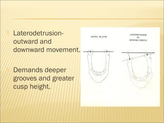    Laterodetrusion-
    outward and
    downward movement.

   Demands deeper
    grooves and greater
    cusp height.
 