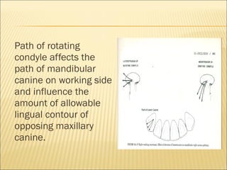 Path of rotating
condyle affects the
path of mandibular
canine on working side
and influence the
amount of allowable
lingual contour of
opposing maxillary
canine.
 