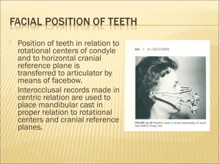    Position of teeth in relation to
    rotational centers of condyle
    and to horizontal cranial
    reference plane is
    transferred to articulator by
    means of facebow.
   Interocclusal records made in
    centric relation are used to
    place mandibular cast in
    proper relation to rotational
    centers and cranial reference
    planes.
 