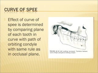    Effect of curve of
    spee is determined
    by comparing plane
    of each tooth in
    curve with path of
    orbiting condyle
    with same rule as
    in occlusal plane.
 