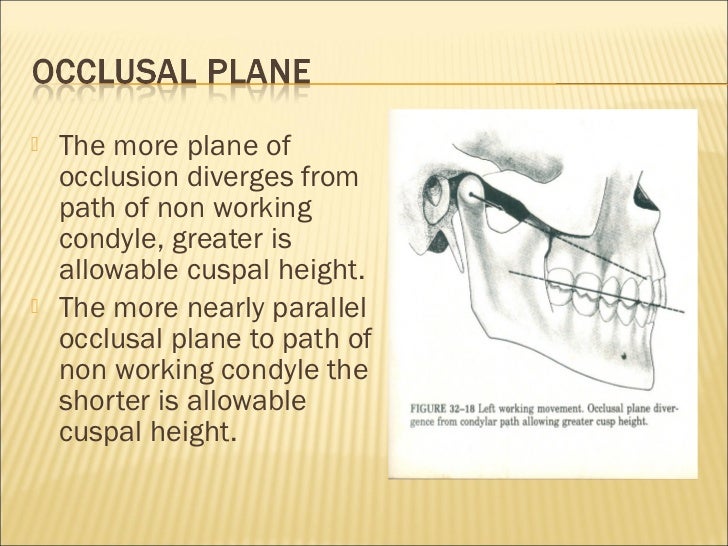 Occlusion ppt
