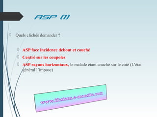 ASP (1)
 Quels clichés demander ?
 ASP face incidence debout et couché
 Centré sur les coupoles
 ASP rayons horizontaux, le malade étant couché sur le coté (L’état
général l’impose)
 
