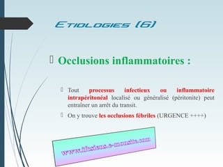 Etiologies (6)
 Occlusions inflammatoires :
 Tout processus infectieux ou inflammatoire
intrapéritonéal localisé ou généralisé (péritonite) peut
entraîner un arrêt du transit.
 On y trouve les occlusions fébriles (URGENCE ++++)
 