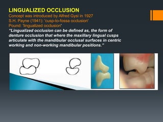 LINGUALIZED OCCLUSION
Concept was introduced by Alfred Gysi in 1927
S.H. Payne (1941): 'cusp-to-fossa occlusion'
Pound: 'lingualized occlusion'
“Lingualized occlusion can be defined as, the form of
denture occlusion that where the maxillary lingual cusps
articulate with the mandibular occlusal surfaces in centric
working and non-working mandibular positions.”
 
