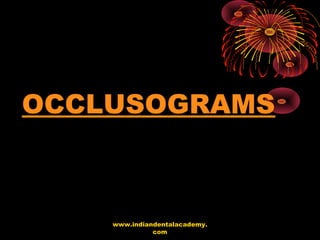 OCCLUSOGRAMS
www.indiandentalacademy.
com
 