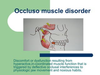 Occluso muscle disorder




Discomfort or dysfunction resulting from
hyperactive,in-coordinated muscle function that is
triggered by deflective occlusal interferences to
physiologic jaw movement and noxious habits.
 