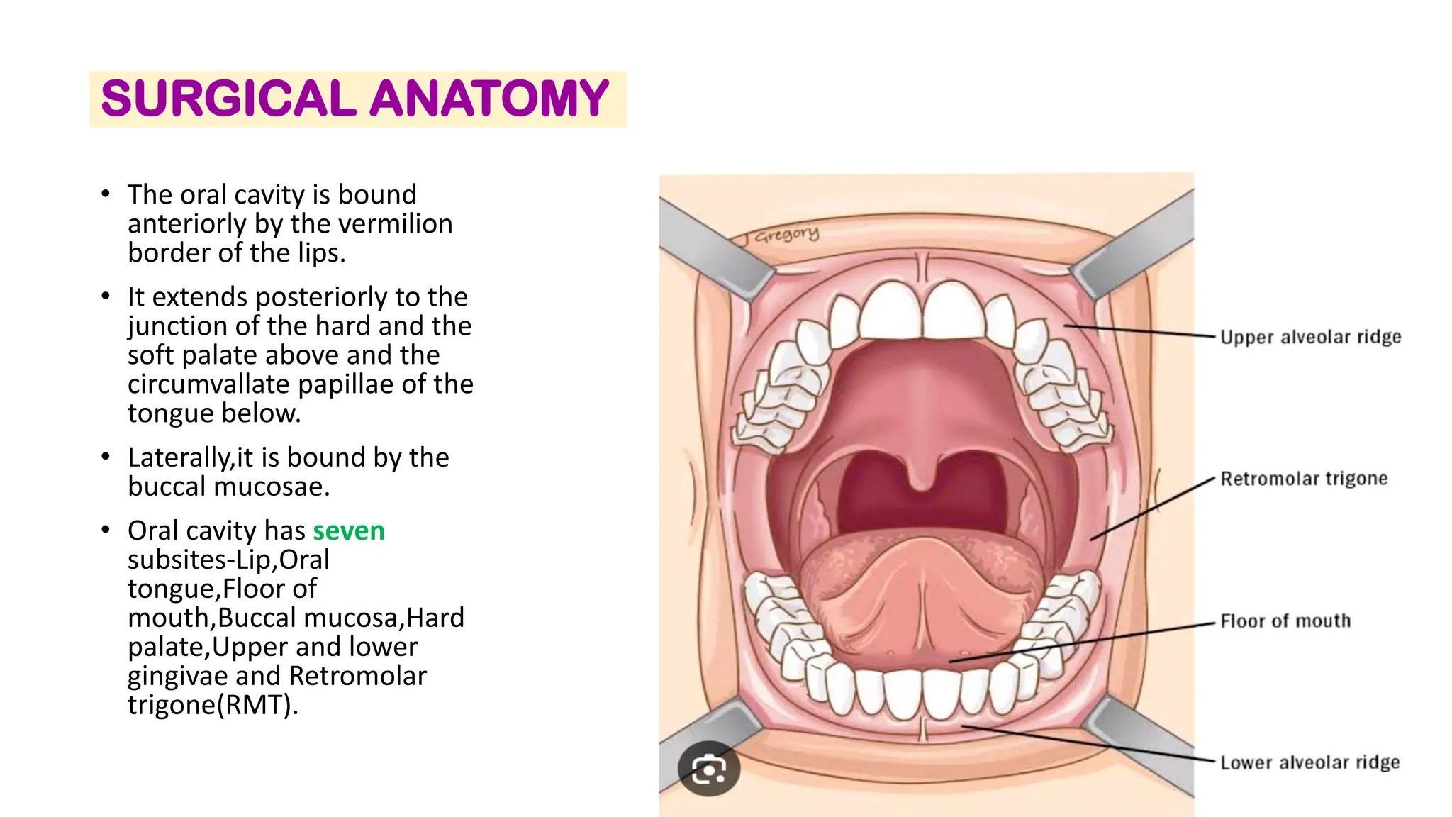 ORAL CAVITY CANCER RESECTIONS:MANDIBULECTOMY & GLOSSECTOMY | PDF