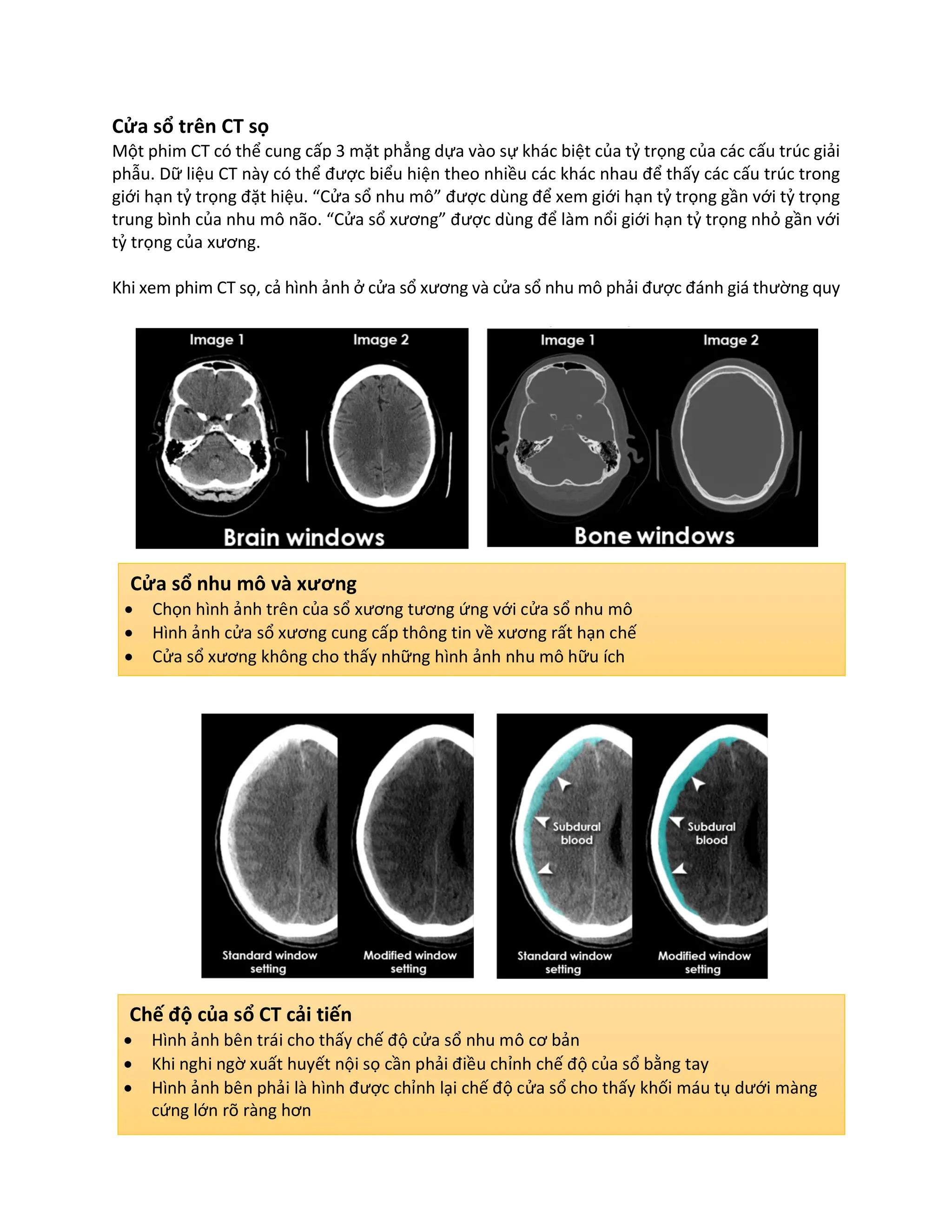 ĐỌC CT SỌ CƠ BẢN đại học y dược Huế.pdf