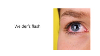 Occupational Health part 1