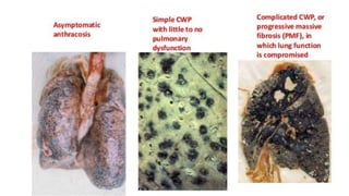 Occupational Health part 1